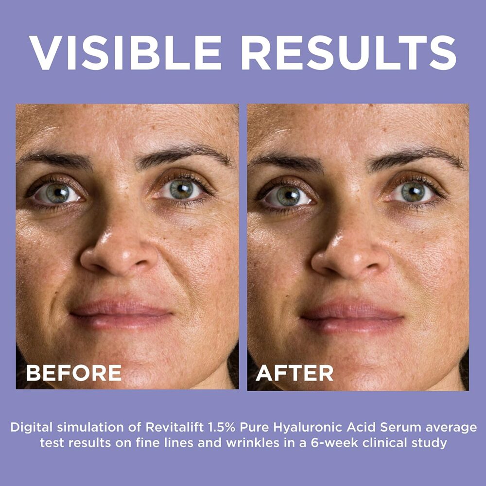 L’Oréal Paris Revitalift 1.5% Pure Hyaluronic Acid Face Serum - Image 2
