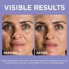 L’Oréal Paris Revitalift 1.5% Pure Hyaluronic Acid Face Serum - Image 2